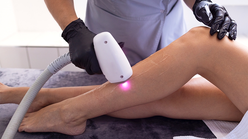 Debunking-Common-Myths-About-Laser-Therapy